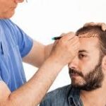 زراعة الشعر في الرياض