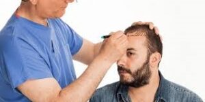 زراعة الشعر في الرياض