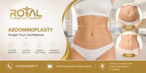 abdominoplasty