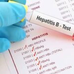 Hepatitis B and C Test Price in Pakistan
