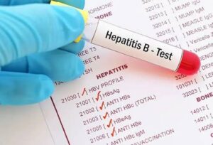 Hepatitis B and C Test Price in Pakistan