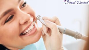 Teeth Cleaning Gladstone