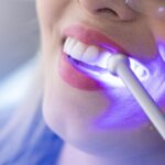 teeth whitening services