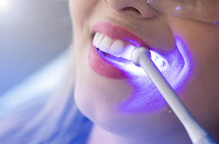 teeth whitening services