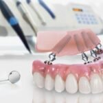 wisdomdentalsix