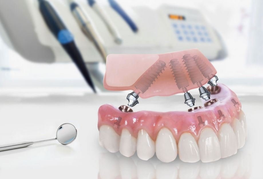 wisdomdentalsix
