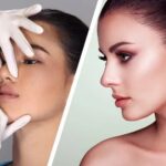 تجميل الأنف في دبي