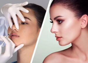 تجميل الأنف في دبي