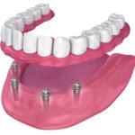 dental care