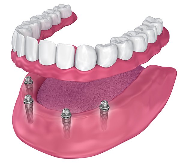 dental care