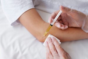 PRP Therapy