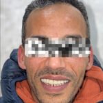 Implants Dentaires