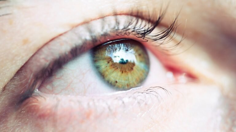 udi Arabia Contact Lenses Market