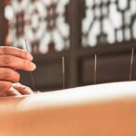 Skilled Acupuncturists in Scarborough, ON