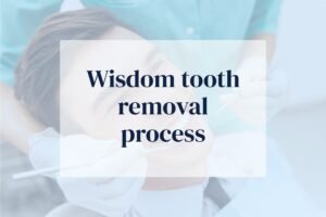 wisdom tooth removal basingstoke
