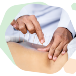 acupuncture in Calgary