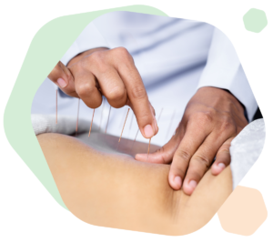acupuncture in Calgary