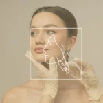 Botox in Dubai