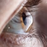 LASIK Eye Surgery London (2)