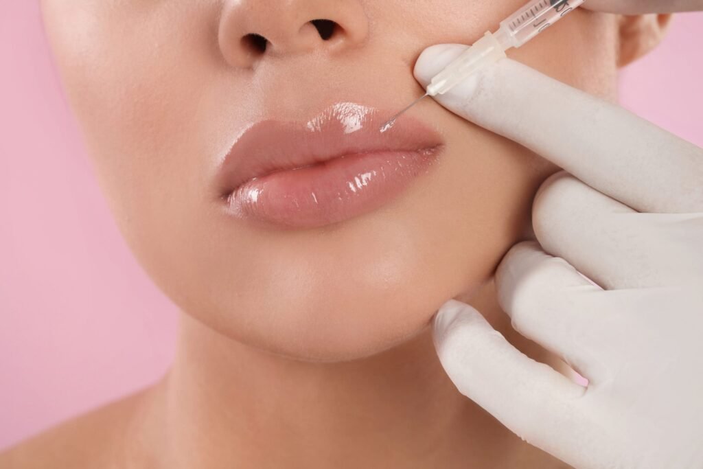 Lip Fillers in Dubai