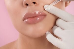 Lip Fillers in Dubai
