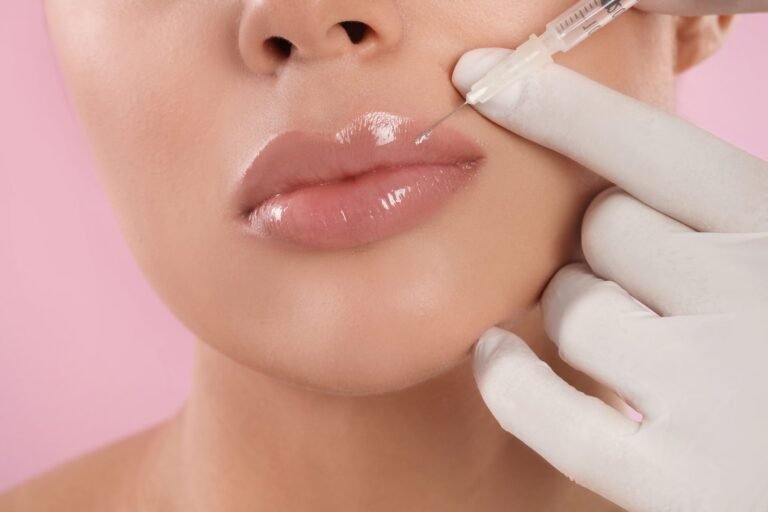 Lip Fillers in Dubai