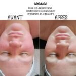 Épilation IPL à Saint-Georges Québec