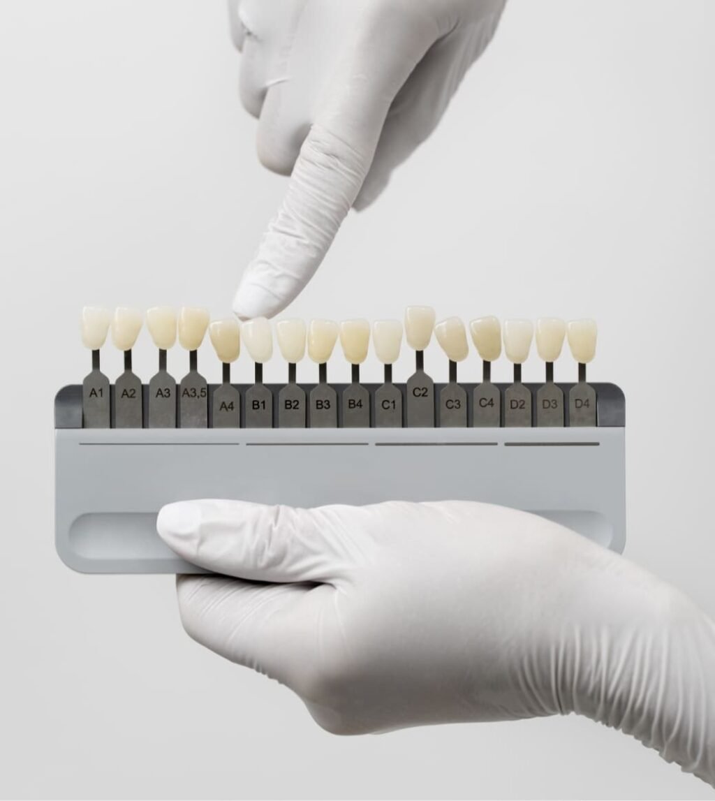composite veneers dubai