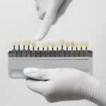 composite veneers dubai