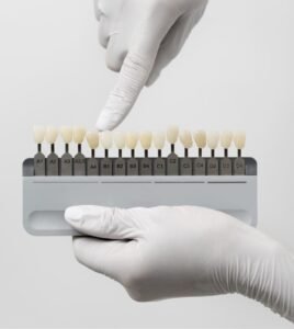 composite veneers dubai