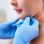 kybella treatment san carlos ca