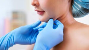 kybella treatment san carlos ca