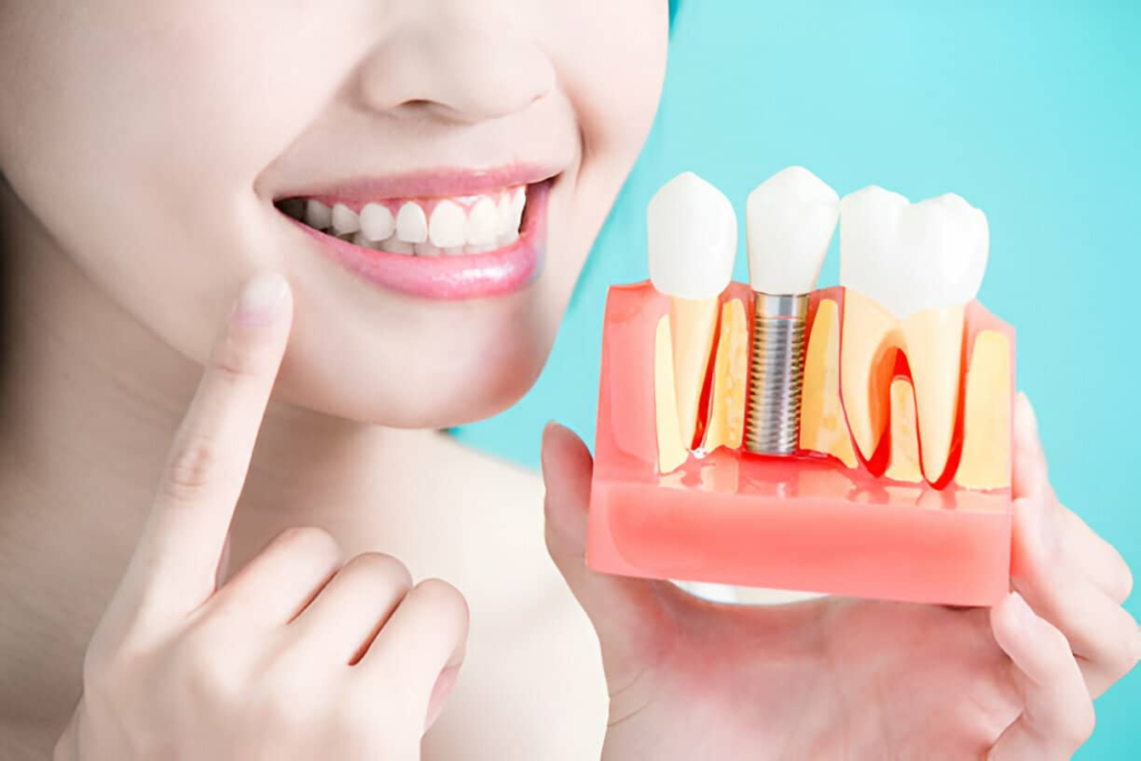Renew Your Confidence with Professional Dental Implants in Cantonment, FL