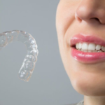 Achieve Your Dream Smile with Invisalign in Tustin, CA