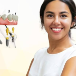 Restore Your Smile with Dental Implants in Pell City, AL