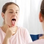 Burning Mouth Syndrome Remedies