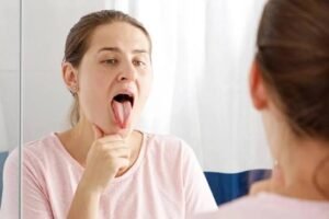 Burning Mouth Syndrome Remedies