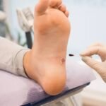 At-Home Wound Assessment and Dressing Changes Troy MI