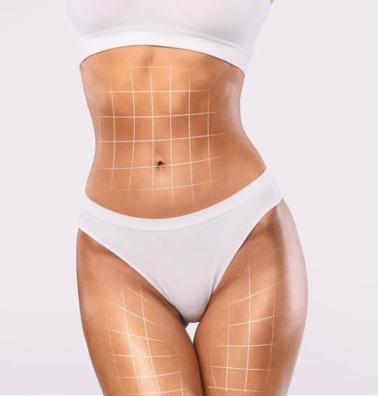 Tummy Tuck Surgery In Dubai