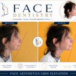 Adult Jaw Correction Specialist