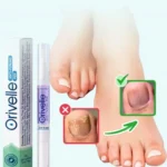 Orville for Toenail Fungus