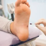 advanced home wound treatment troy michigan