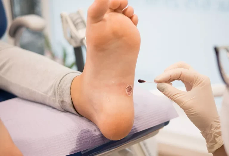 advanced home wound treatment troy michigan